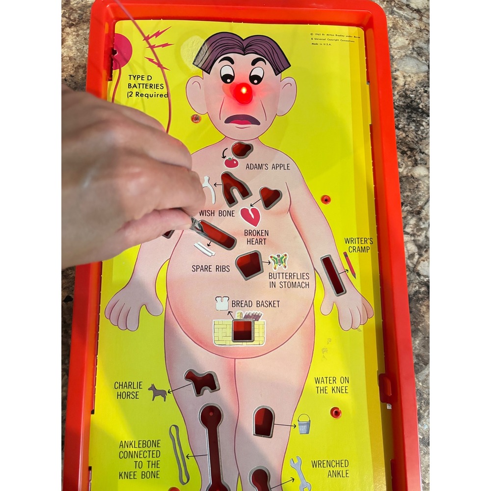 Vintage Game Operation 1965 Milton Bradley Skill Game Retro Toy - Picture 2 of 9